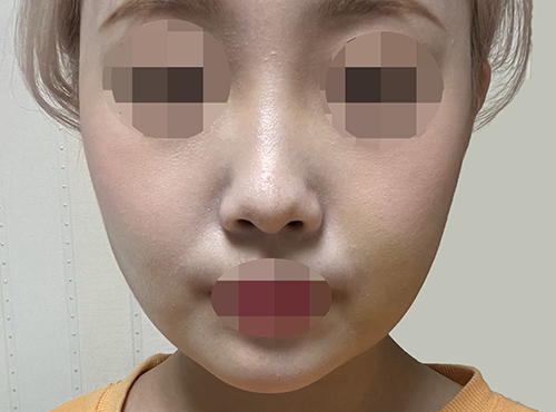 3f66843164098bb051e6db62fb4ddf9c_1739175620_4679.jpg 3f66843164098bb051e6db62fb4ddf9c_1739175620_4679.jpg